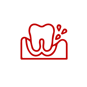 Periodontal (Gum) Treatment